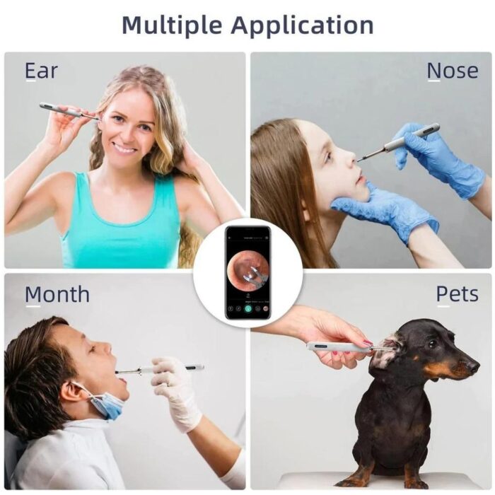 Bebird Note 3 Pro Visual Ear Camera Cleaner - Image 3