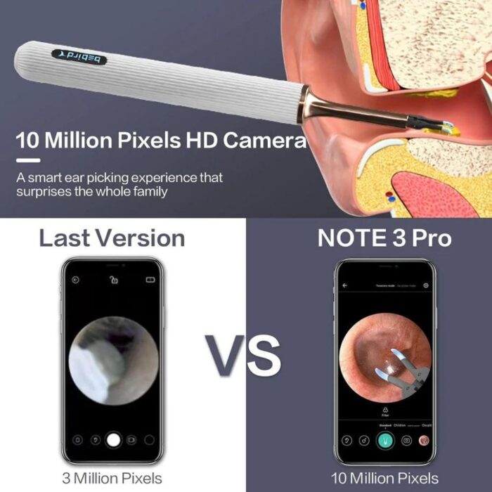 Bebird Note 3 Pro Visual Ear Camera Cleaner - Image 6