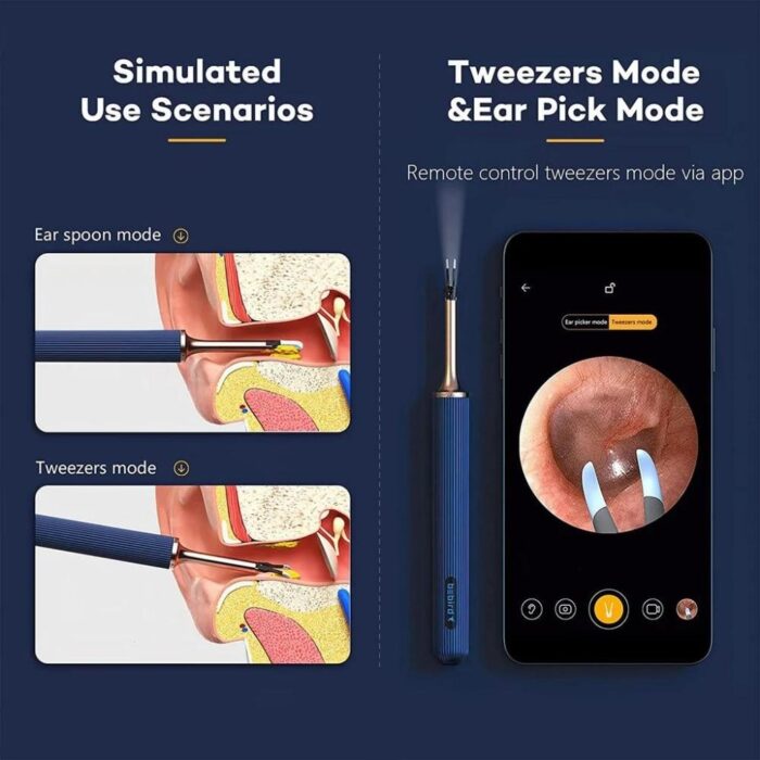 Bebird Note 3 Pro Visual Ear Camera Cleaner - Image 4